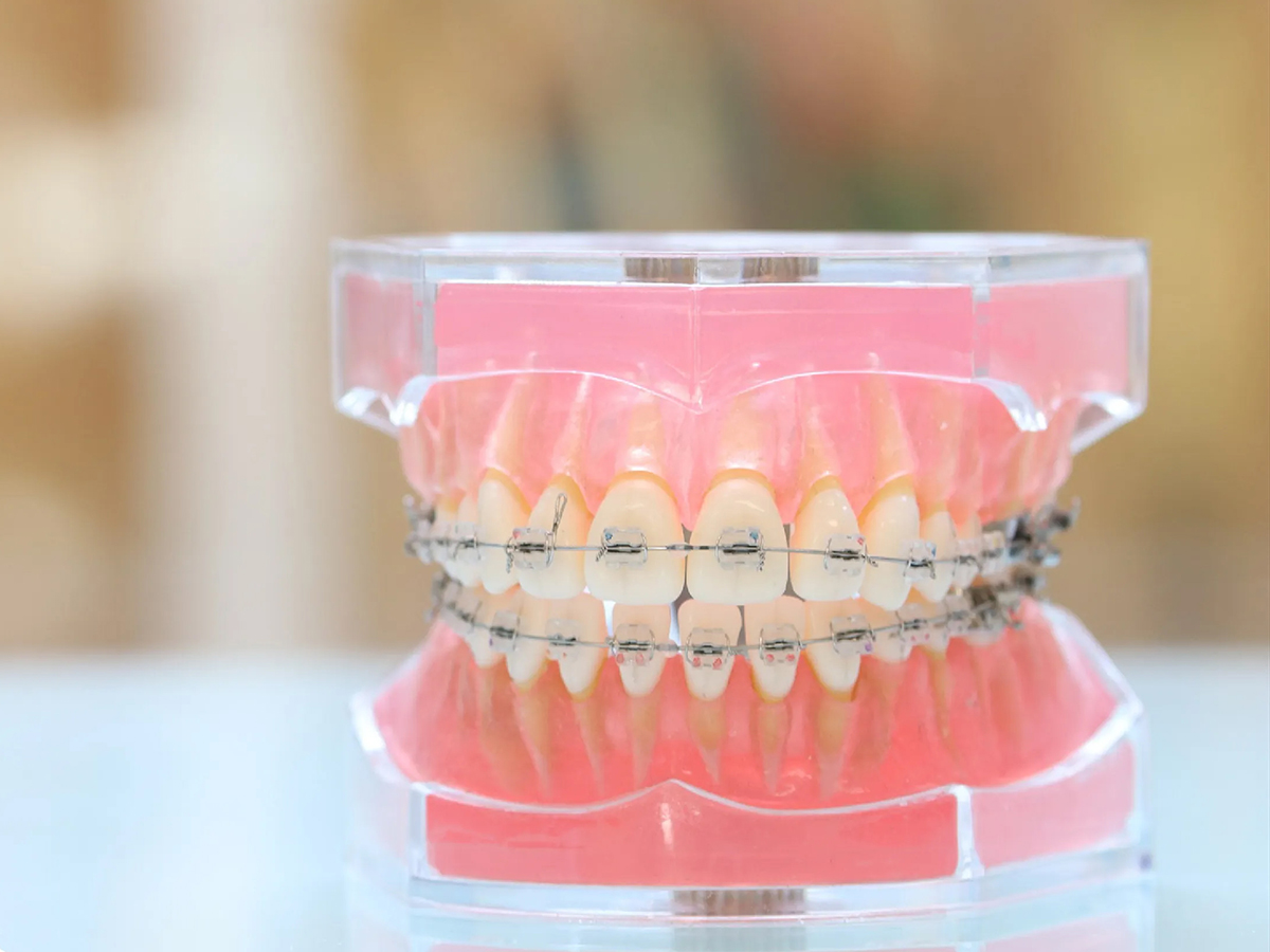 矯正歯科 - 綾瀬・亀有のおすすめ歯医者｜綾瀬亀有ロハス歯科＆矯正